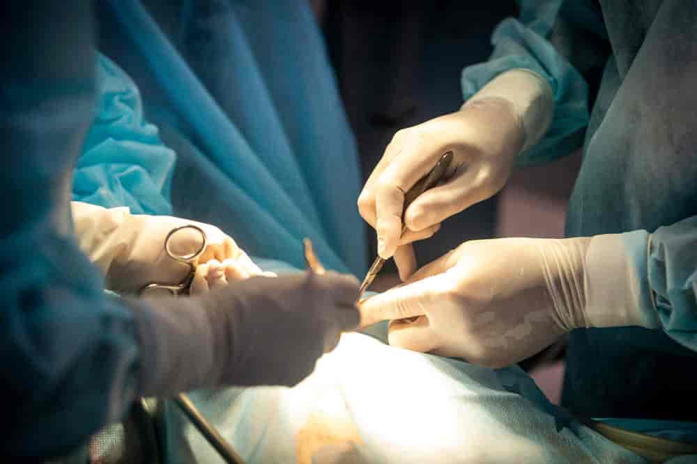 laser fistula Treatment