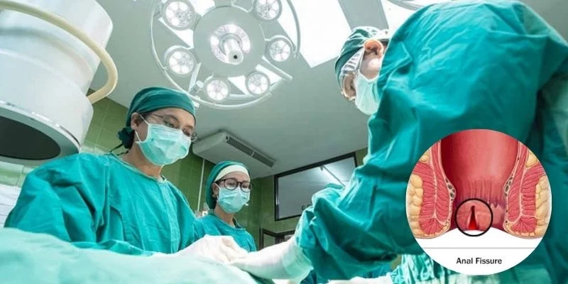 laser surgery for fissure